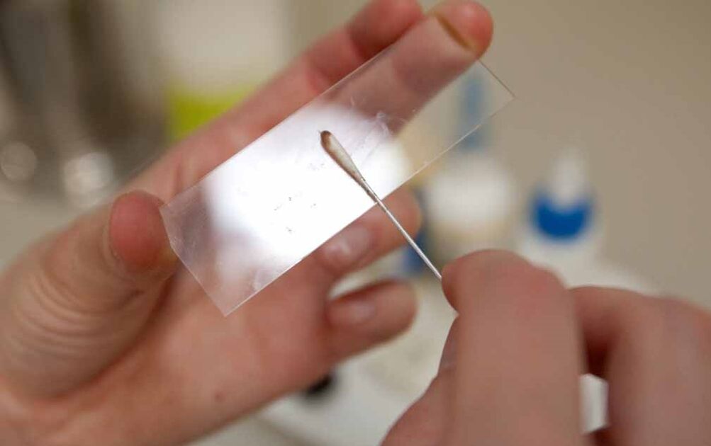 răzuirea pentru prezența paraziților în organism